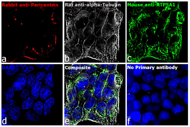 Rat IgG (H+L) Cross-Adsorbed Secondary Antibody in Immunocytochemistry (ICC/IF)