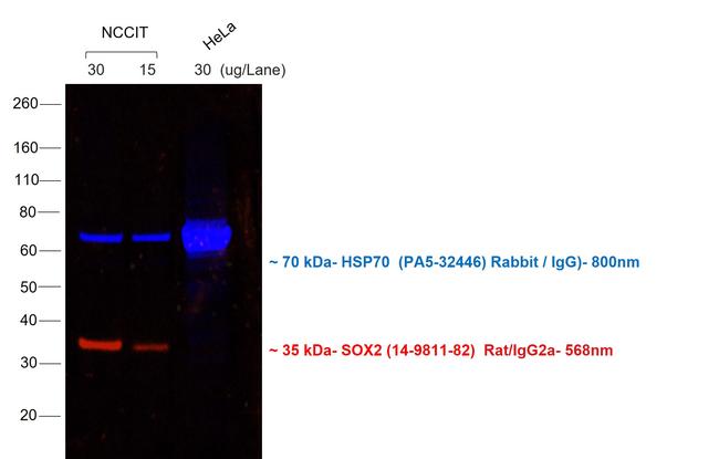 Rat IgG (H+L) Cross-Adsorbed Secondary Antibody in Western Blot (WB)