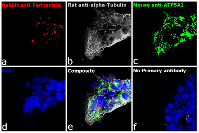 Rat IgG (H+L) Cross-Adsorbed Secondary Antibody in Immunocytochemistry (ICC/IF)