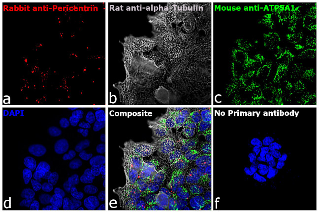 Rat IgG (H+L) Cross-Adsorbed Secondary Antibody in Immunocytochemistry (ICC/IF)