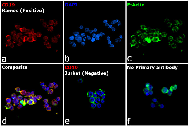 Rat IgG (H+L) Cross-Adsorbed Secondary Antibody in Immunocytochemistry (ICC/IF)