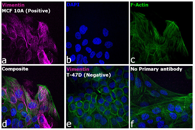 Rabbit IgG (H+L) Cross-Adsorbed Secondary Antibody in Immunocytochemistry (ICC/IF)