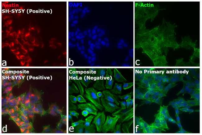 Mouse IgG (H+L) Cross-Adsorbed Secondary Antibody in Immunocytochemistry (ICC/IF)