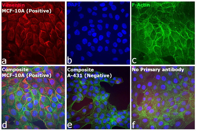 Rabbit IgG (H+L) Secondary Antibody in Immunocytochemistry (ICC/IF)