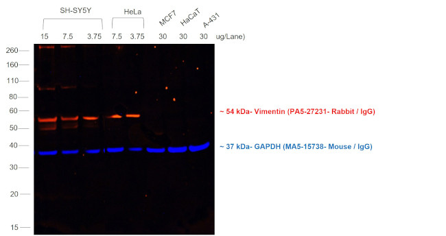 Rabbit IgG (H+L) Secondary Antibody in Western Blot (WB)