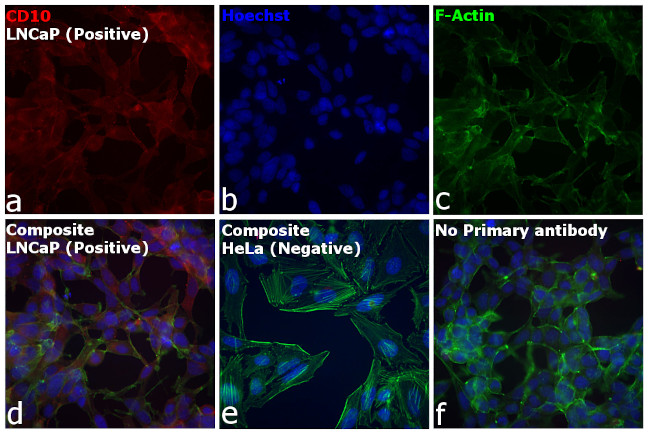 Goat IgG (H+L) Cross-Adsorbed Secondary Antibody in Immunocytochemistry (ICC/IF)