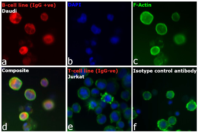 Human IgG (H+L) Cross-Adsorbed Secondary Antibody in Immunocytochemistry (ICC/IF)