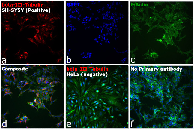 Goat anti-Mouse IgG2a Cross-Adsorbed, Alexa Fluor™ 594 (A-21135)