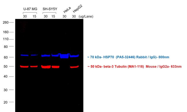 Goat anti-Mouse IgG2a Cross-Adsorbed Secondary Antibody, Alexa Fluor™ 633