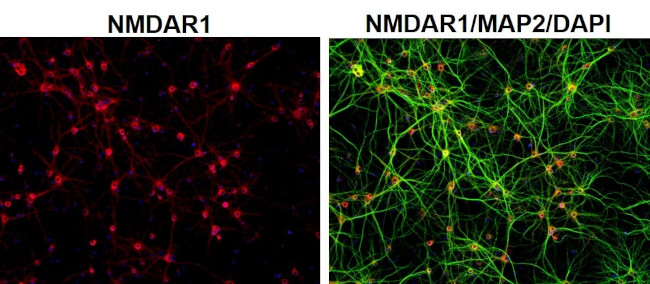 Mouse IgG (H+L) Highly Cross-Adsorbed Secondary Antibody in Immunocytochemistry (ICC/IF)