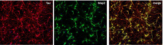 Mouse IgG (H+L) Highly Cross-Adsorbed Secondary Antibody in Immunocytochemistry (ICC/IF)