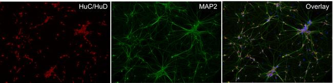 Mouse IgG (H+L) Highly Cross-Adsorbed Secondary Antibody in Immunocytochemistry (ICC/IF)