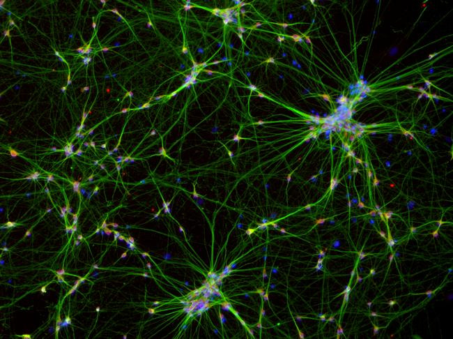 Mouse IgG (H+L) Highly Cross-Adsorbed Secondary Antibody in Immunocytochemistry (ICC/IF)