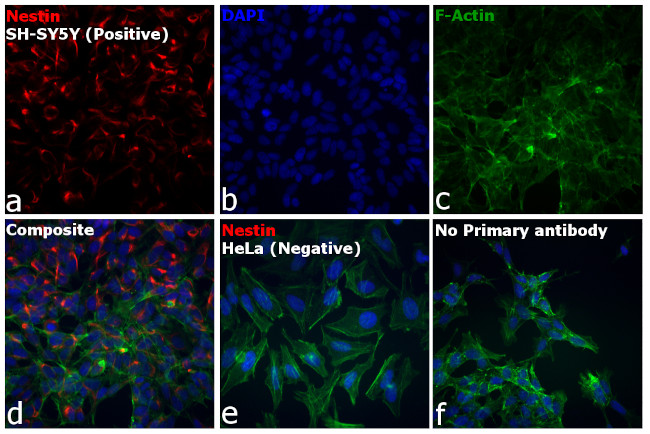 Mouse IgG (H+L) Cross-Adsorbed Secondary Antibody in Immunocytochemistry (ICC/IF)