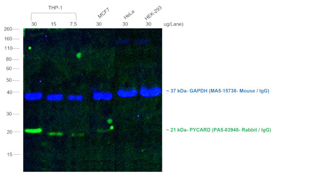 Rabbit IgG (H+L) Cross-Adsorbed Secondary Antibody in Western Blot (WB)