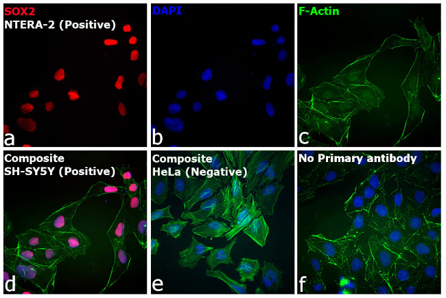 Rat IgG (H+L) Cross-Adsorbed Secondary Antibody in Immunocytochemistry (ICC/IF)