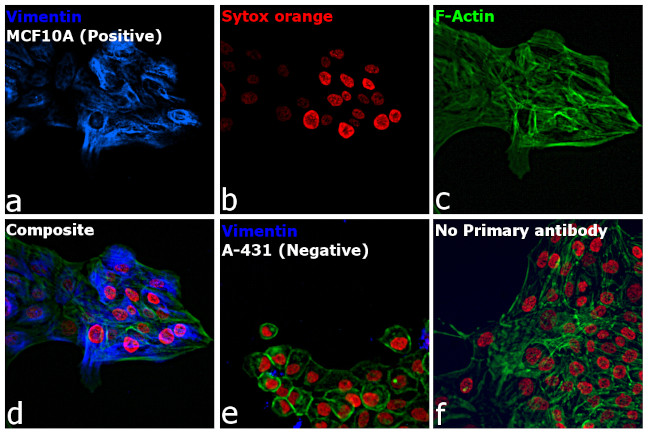 Rabbit IgG (H+L) Highly Cross-Adsorbed Secondary Antibody in Immunocytochemistry (ICC/IF)