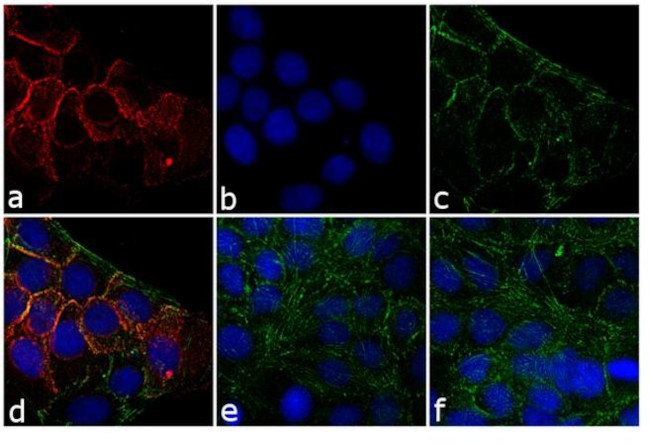 Rabbit IgG (H+L) Secondary Antibody in Immunocytochemistry (ICC/IF)