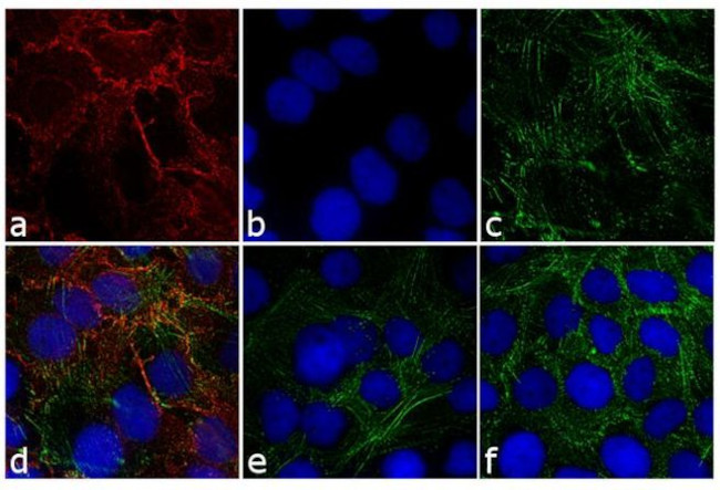 Rabbit IgG (H+L) Cross-Adsorbed Secondary Antibody in Immunocytochemistry (ICC/IF)