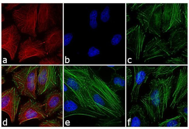 Mouse IgG (H+L) Cross-Adsorbed Secondary Antibody in Immunocytochemistry (ICC/IF)