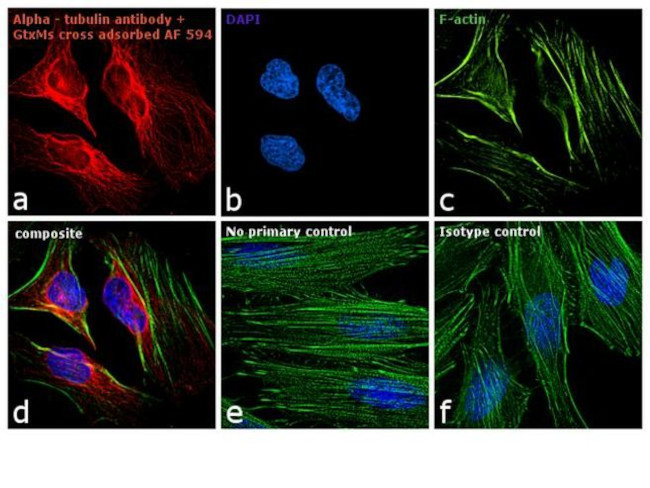 Mouse IgG (H+L) Cross-Adsorbed Secondary Antibody in Immunocytochemistry (ICC/IF)