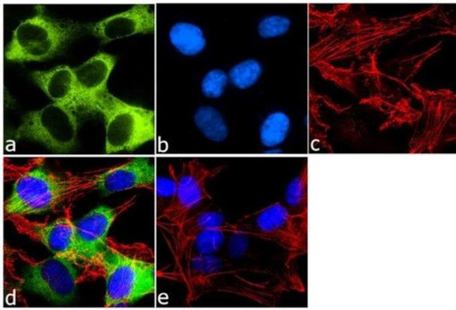 Mouse IgG (H+L) Highly Cross-Adsorbed Secondary Antibody in Immunocytochemistry (ICC/IF)