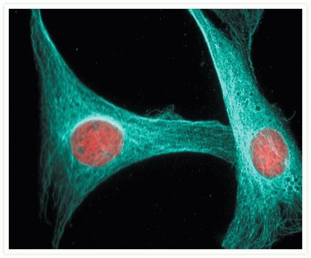 alpha Tubulin Antibody in Immunocytochemistry (ICC/IF)