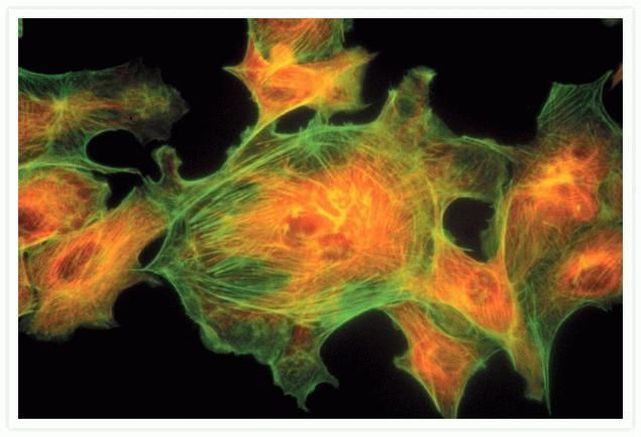 alpha Tubulin Antibody in Immunocytochemistry (ICC/IF)