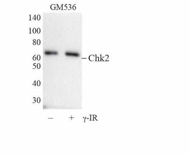 CHK2 Antibody in Western Blot (WB)