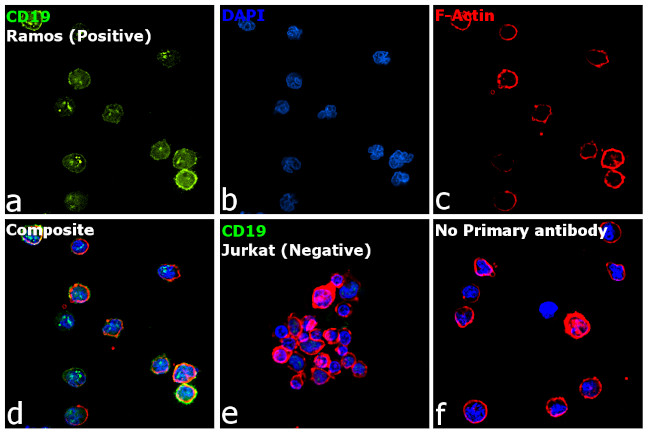 Rat Kappa Light Chain Secondary Antibody in Immunocytochemistry (ICC/IF)