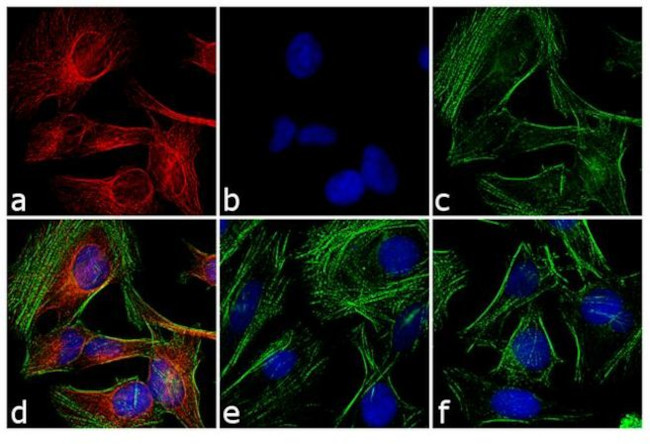 Rabbit IgG (H+L) Secondary Antibody in Immunocytochemistry (ICC/IF)