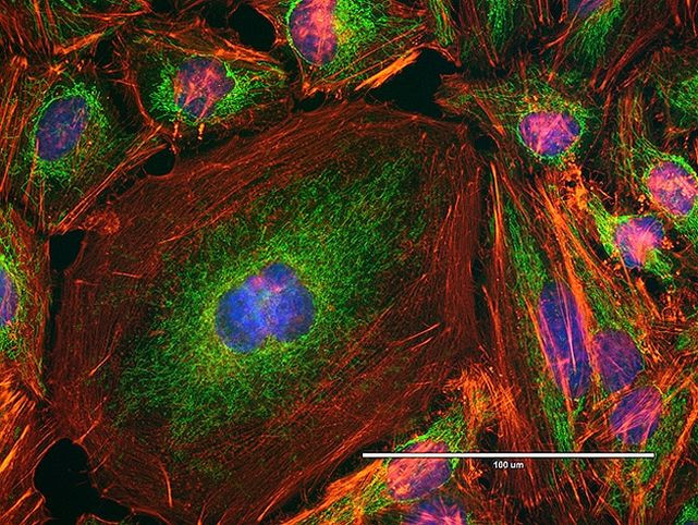 Mouse IgG (H+L) Highly Cross-Adsorbed Secondary Antibody in Immunocytochemistry (ICC/IF)