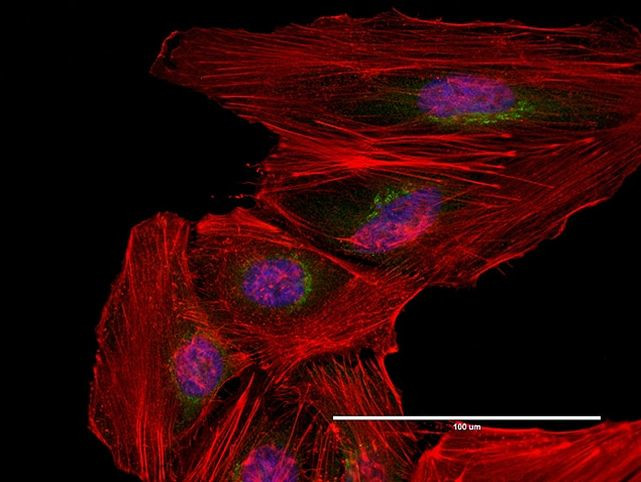 Mouse IgG (H+L) Highly Cross-Adsorbed Secondary Antibody in Immunocytochemistry (ICC/IF)