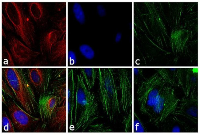 Mouse IgG (H+L) Secondary Antibody in Immunocytochemistry (ICC/IF)