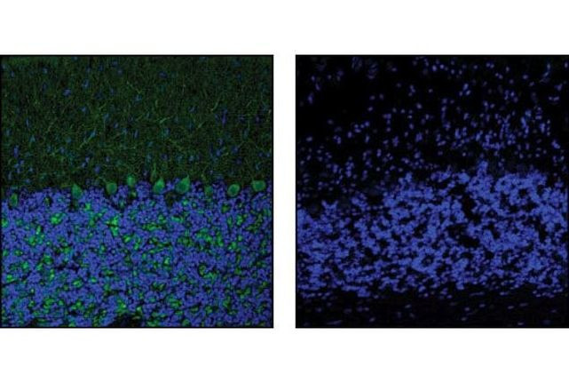 p35 Antibody in Immunohistochemistry (IHC)