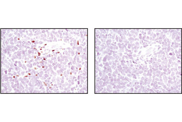 ALOX5 Antibody in Immunohistochemistry (Paraffin) (IHC (P))