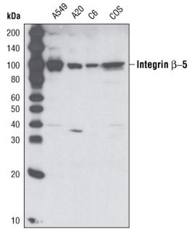 ITGB5 Antibody in Western Blot (WB)