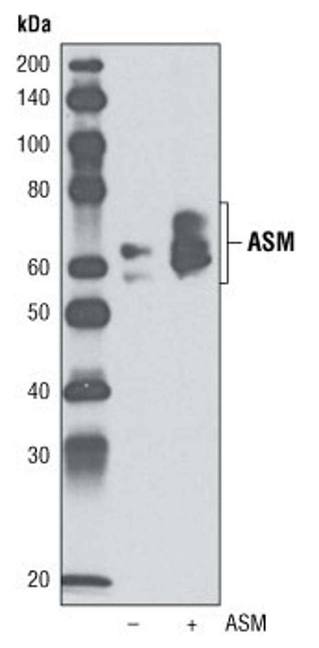 ASM Antibody in Western Blot (WB)