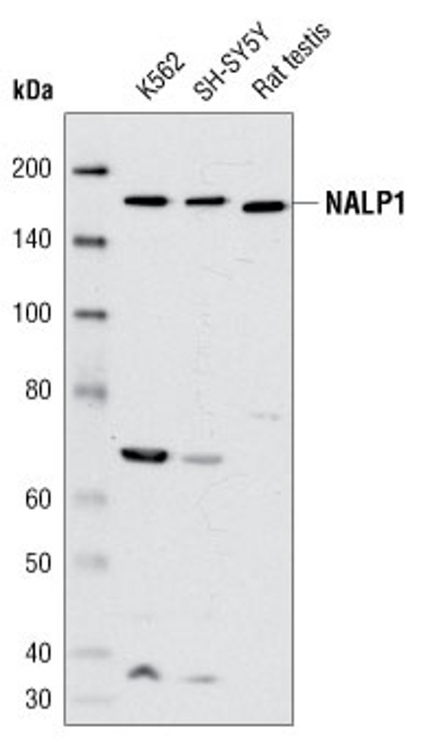 NALP1 Antibody in Western Blot (WB)