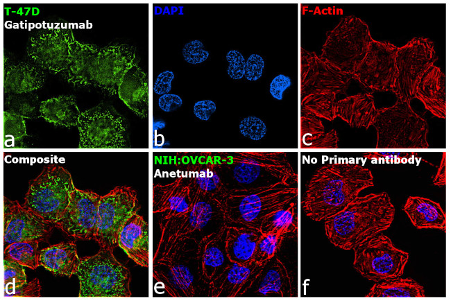 Human Kappa Light Chain Secondary Antibody in Immunocytochemistry (ICC/IF)