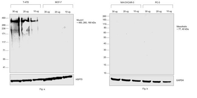 Human Kappa Light Chain Secondary Antibody in Western Blot (WB)