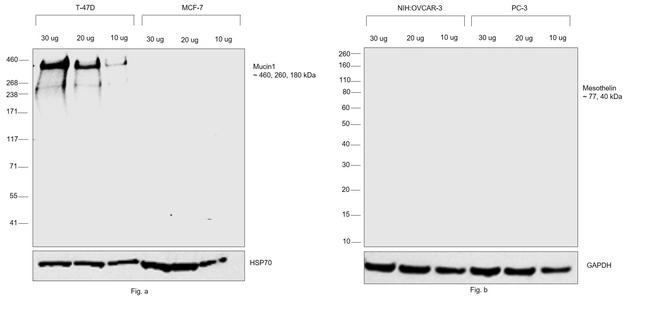 Human Kappa Light Chain Cross-Adsorbed Secondary Antibody in Western Blot (WB)