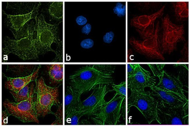 Rat IgG (H+L) Cross-Adsorbed Secondary Antibody in Immunocytochemistry (ICC/IF)