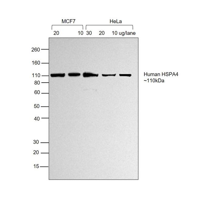 Human IgG (H+L) Secondary Antibody in Western Blot (WB)