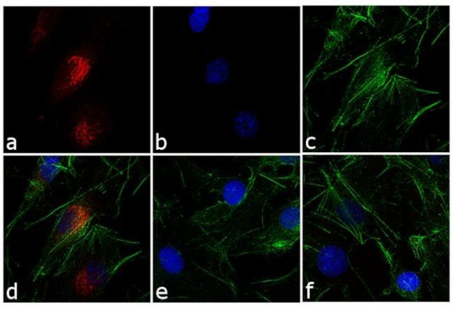 Rabbit IgG (H+L) Secondary Antibody in Immunocytochemistry (ICC/IF)