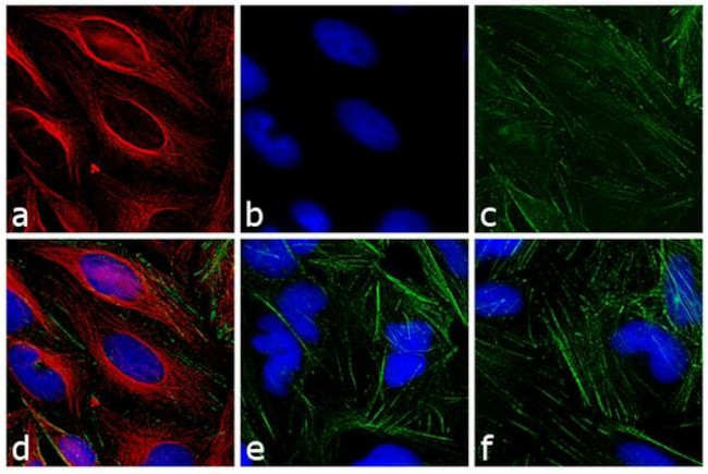 Mouse IgG (H+L) Highly Cross-Adsorbed Secondary Antibody in Immunocytochemistry (ICC/IF)