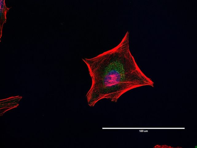 Golgin-97 Antibody in Immunocytochemistry (ICC/IF)