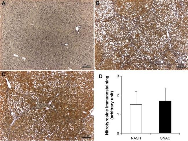 Nitrotyrosine Antibody in Immunohistochemistry (IHC)