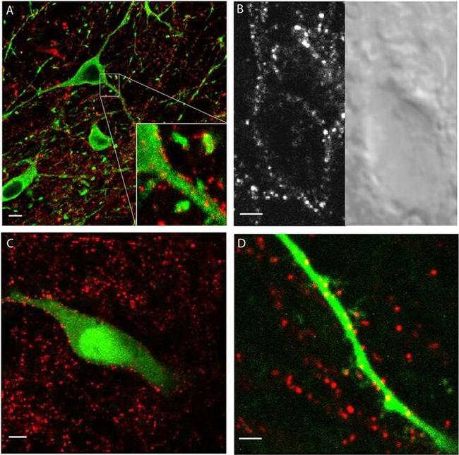 GFP Antibody in Immunohistochemistry (IHC)