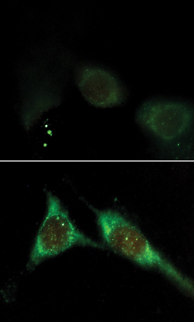 Phosphatidylinositol 3,4,5-trisphosphate Antibody in Immunocytochemistry (ICC/IF)